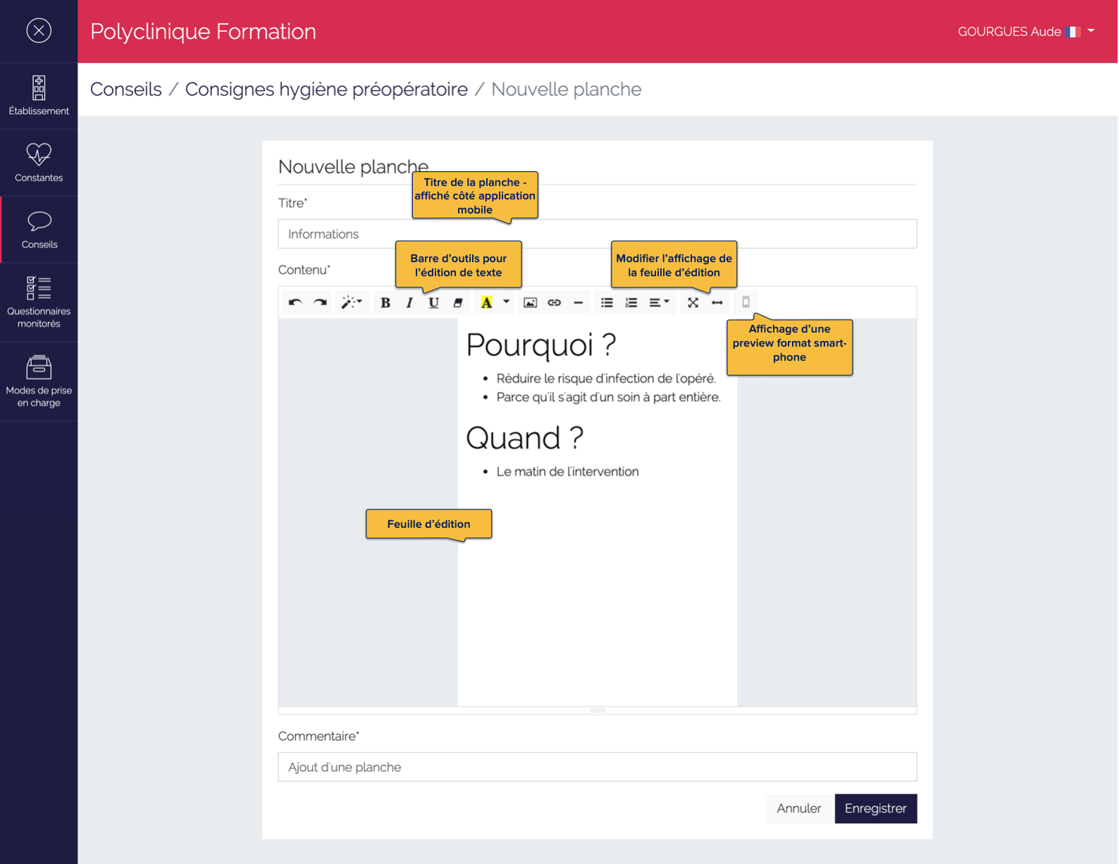 Page d'édition d'une planche d'un conseil